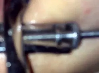 Shemale Uses Speculum On Me With Toys And Anal Play