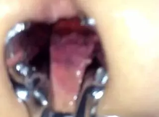 Shemale Uses Speculum On Me With Toys And Anal Play