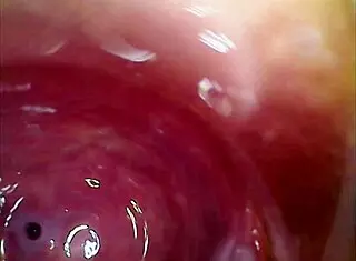 Real Pussy Orgasm Contractions With Cum Inside Under Microscope