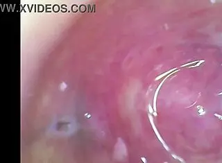 Real Pussy Orgasm Contractions With Cum Inside Under Microscope