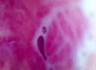 Real Pussy Orgasm Contractions With Cum Inside Under Microscope