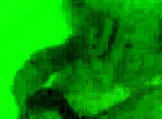 Mary White Hospital Patient