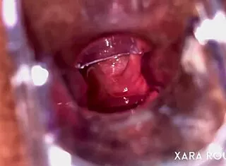 Anal Vision Speculum Reveals Mature BBW's Gaping Tight Hole