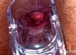 Anal Vision Speculum Reveals Mature BBW's Gaping Tight Hole