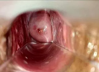 Pulsating vagina orgasm throbs intensely with speculum view
