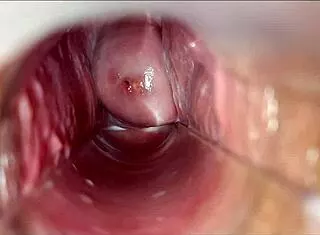 Pulsating vagina orgasm throbs intensely with speculum view