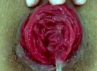 check this destroyed juicy milf anal prolapse gaping closeup play