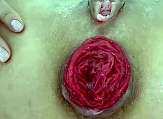 check this destroyed juicy milf anal prolapse gaping closeup play