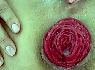 check this destroyed juicy milf anal prolapse gaping closeup play