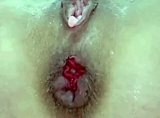 check this destroyed juicy milf anal prolapse gaping closeup play