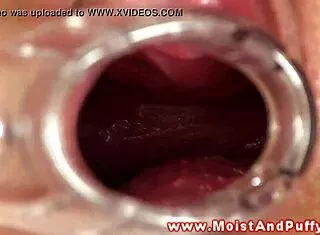Puffy peach teen 18+ plays with speculum