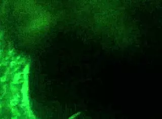 I remember that passionate spitting session from back then.