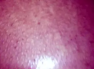 in the hood, squirting?