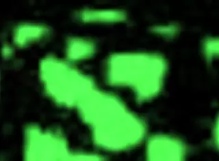 Female nurses give me hitachi orgasms during physical