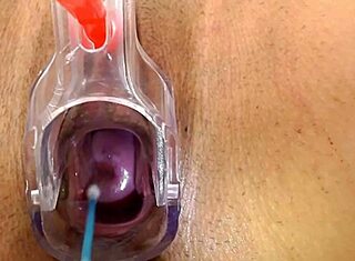 Co se skrývá v Lilyiných exkluzivních gynekologických fetiš videích?