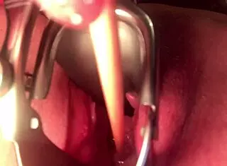 cervix insertion stretching procedure