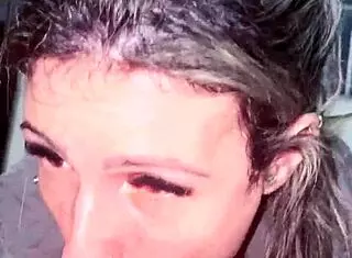 bit my thing in the suck