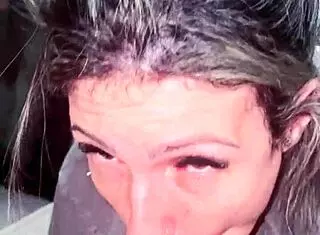 bit my thing in the suck