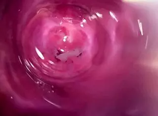 Camera Inside My Horny Creamy Pussy Now!